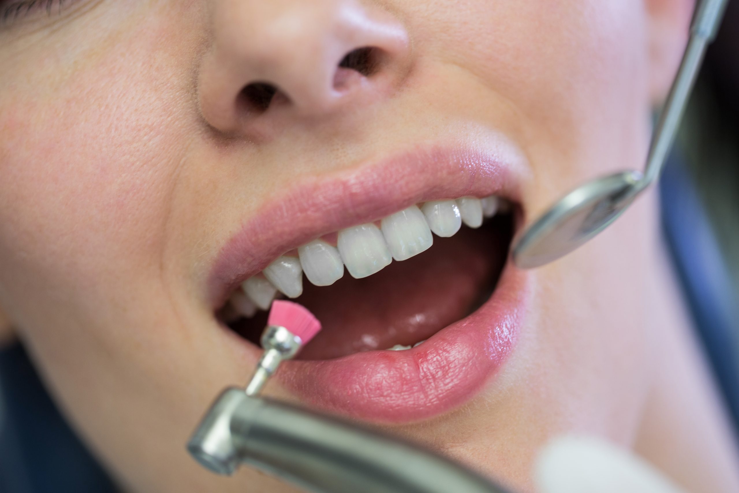 Why Professional Dental Cleanings Are Essential for Long-Term Oral Health