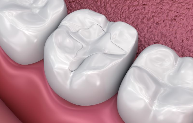 dental fillings near you in atlanta ga
