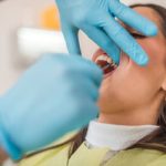 what to expect during tooth removal