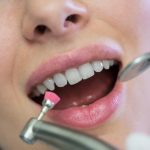 Why Professional Dental Cleanings Are Essential for Long-Term Oral Health